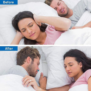 Anti Snore Device